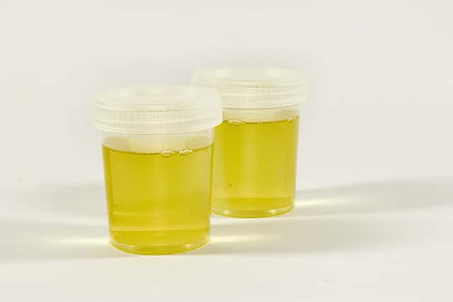 urine testing for measuring hydration
