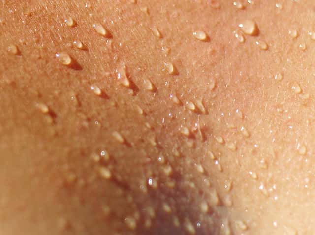 sweating skin