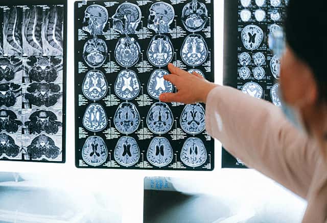 MRI scan results showing body composition analysis