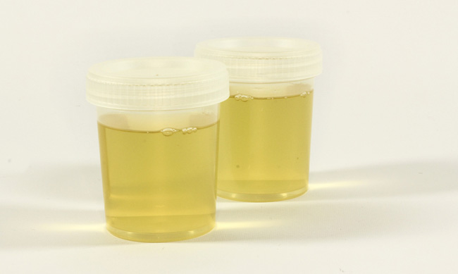 urine test collection