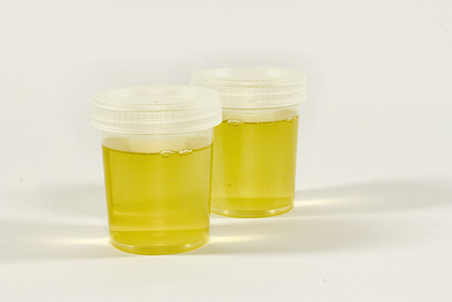 urine testing for measuring hydration