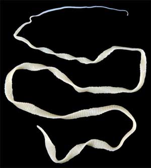 tapeworm